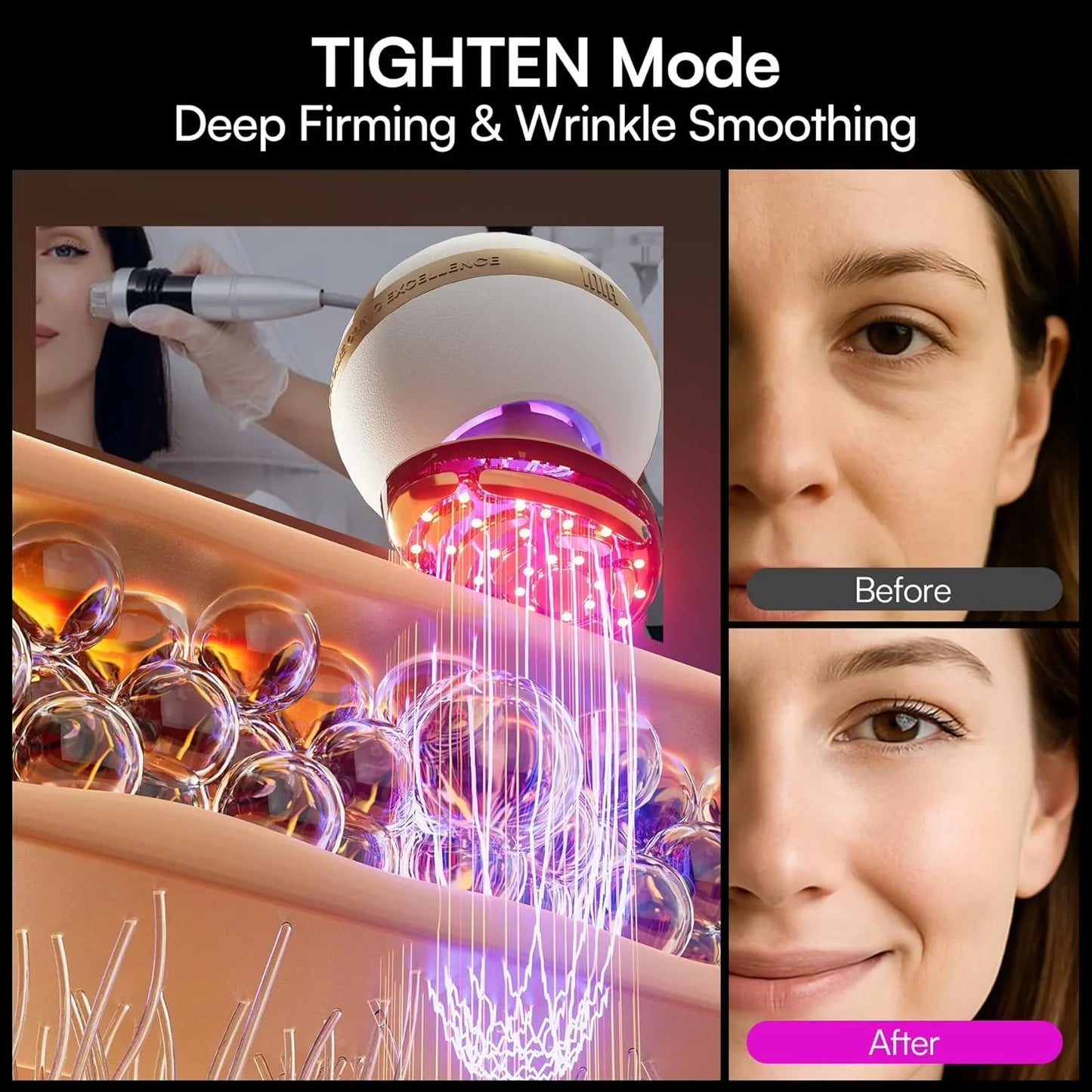 Inia Sphera Upgraded 8-in-1 Microcurrent Facial Device For Face And Neck Red Light