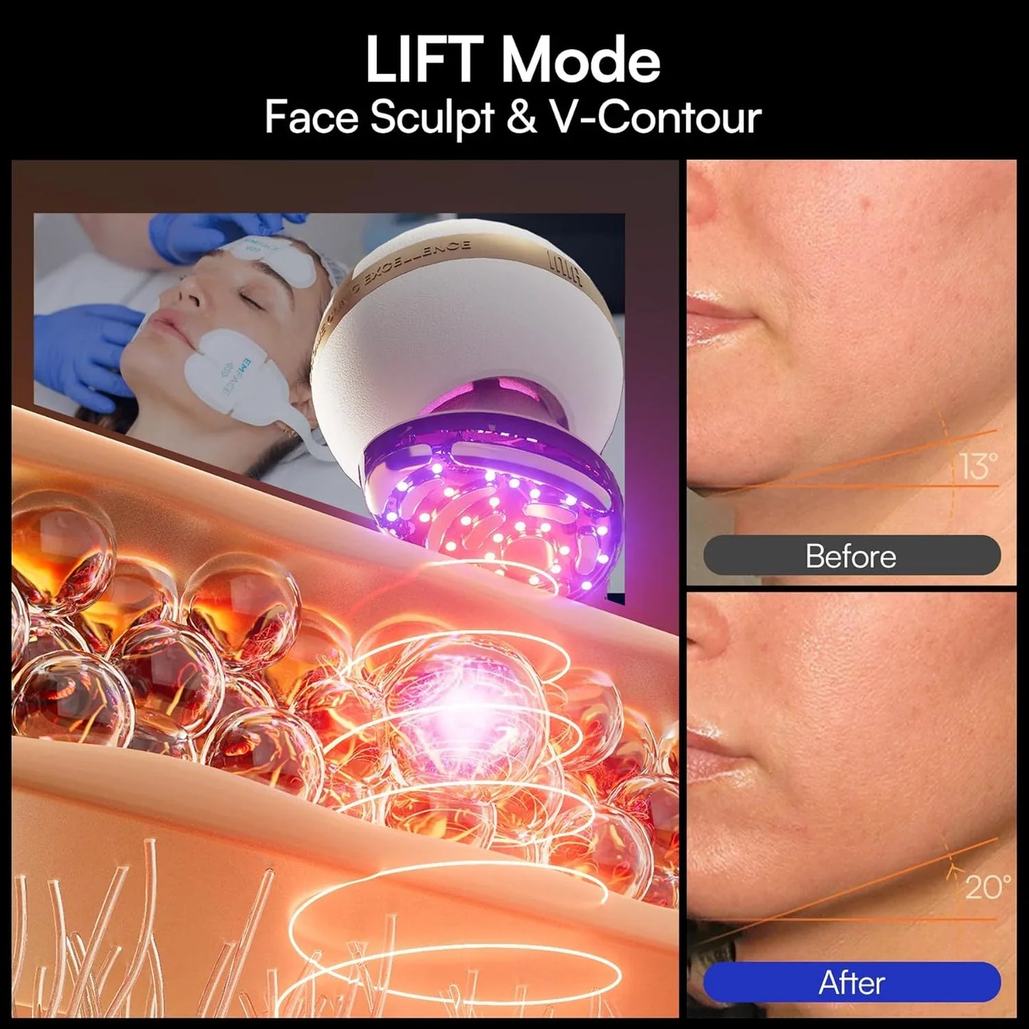 Inia Sphera Upgraded 8-in-1 Microcurrent Facial Device For Face And Neck Red Light