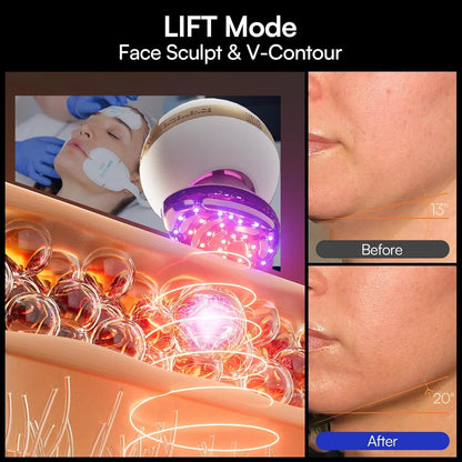 Inia Sphera Upgraded 8-in-1 Microcurrent Facial Device For Face And Neck Red Light