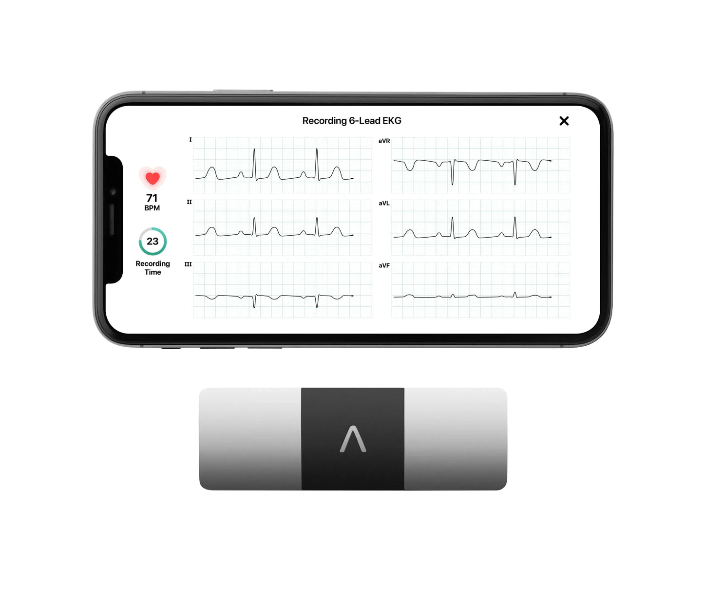 KardiaMobile 6L Personal EKG Monitor With Most Smartphones