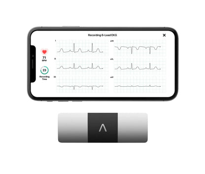 KardiaMobile 6L Personal EKG Monitor With Most Smartphones